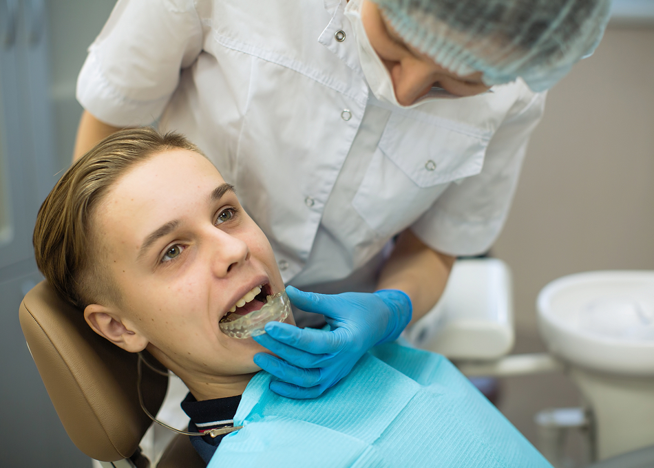 Clear Aligners