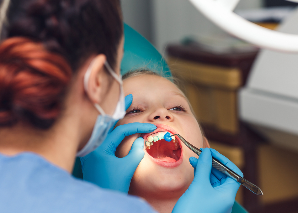 Fluoride Treatment