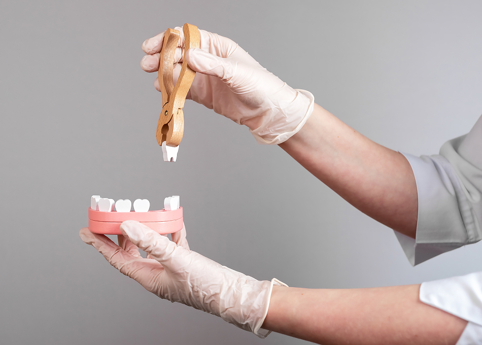 Teeth Extractions